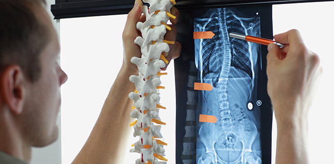 sp-man-spine